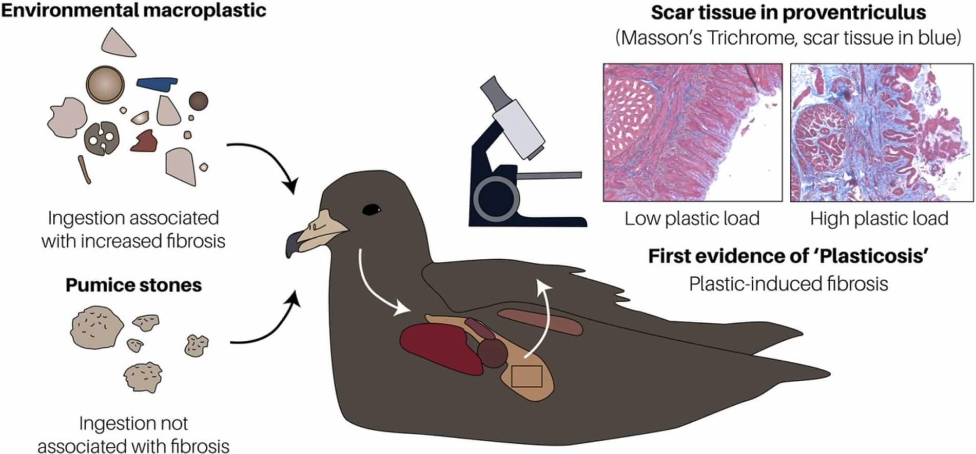 Image from the study '‘Plasticosis’: Characterising macro- and microplastic-associated fibrosis in seabird tissues' showing the effects of plastic pollution on wildlife and the first evidence of 'Plasticosis'.